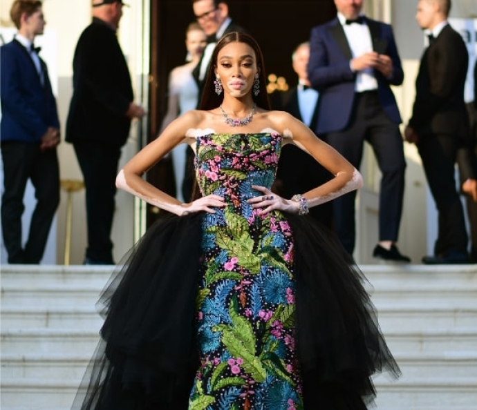 Winnie Harlow